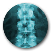 Back X-Ray